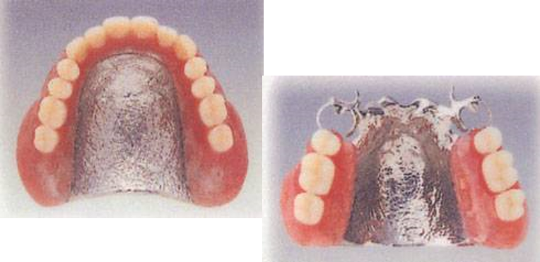 超硬質コバルトクローム 総義歯