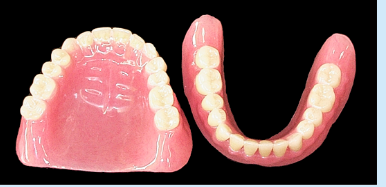 義歯が出来上がり（完成）