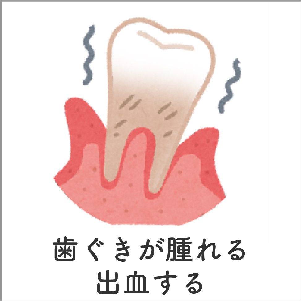 歯ぐきが腫れる・出血する